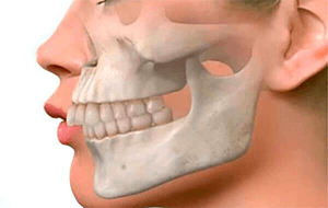 Ortopedia Facial